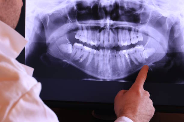 Best Emergency Root Canal Treatment in Mcdonald, OH