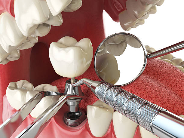 Best Emergency Dentist for Special Needs Patients in Mcdonald, OH